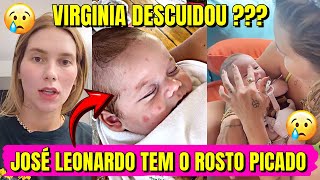 Virginia Se Distraiu? José Leonardo Cheio de Picadas no Rosto!