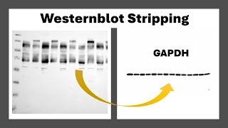 Stripping of Westernblots