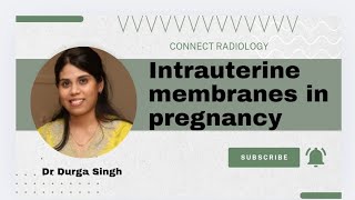 Intrauterine membranes in pregnancy