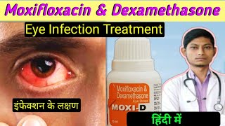 moxifloxacin and dexamethasone eye drops / moxifloxacin & dexamethasone eye drops / moxicip d eye