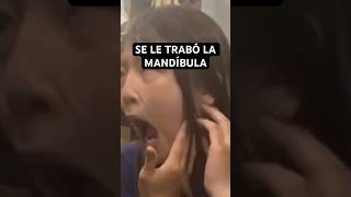 Se le TRABÓ la MANDÍBULA - ¿Qué hacer si se te DESENCAJA?