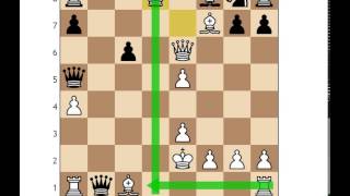 Sinquefield Cup Round 7: Magnus Carlsen vs Hikaru Nakamura