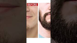 Only 15 Days Beard Growth Oil for Men Hair Growth, Beard Care, Highly recommend,  #youtubeshorts