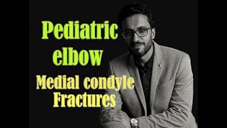 08 Pediatric elbow: Medial condyle fractures