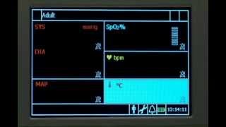 SureSigns VSi Alarms