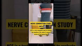 NERVE CONDUCTION STUDY USES AND PROCEDURE l NERVE CONDUCTION TEST l SHARING OF EXPERIENCE I #Shorts