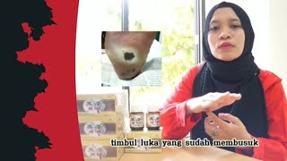 OU TEA UNTUK LUKA DIABETES