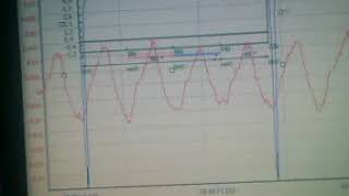 осциллограмма баланса форсунок(датчик вибрации) ТОЙОТА ЯРИС
