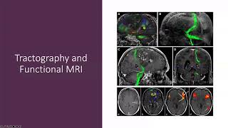 Neurosurgery and Technology - 7/17/2024