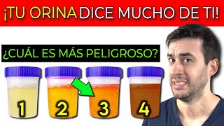 ¡Lo que tu ORINA DICE DE TU SALUD!| 4 SÍNTOMAS INICIALES de INSUFICIENCIA RENAL