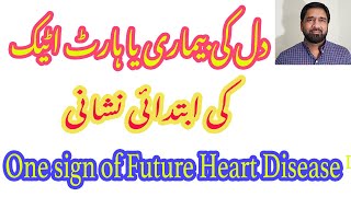 One sign of Future Heart Disease  |  دل کی بیماری یا ہارٹ اٹیک  کی ابتدائی نشانی