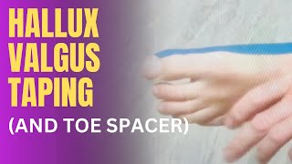 Toe Spacer or Taping for Hallux Valgus