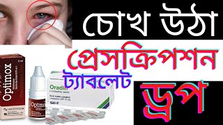 চোখের ড্রপ।। চোখ ওঠার কারণ, লক্ষণ ও চিকিৎসা। করণীয়। Conjunctivitis