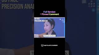 [SHORTS] Revision Facelift in Korea Plastic Surgery Clinic #shorts