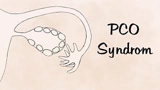 PCO Syndrom? kein Eisprung, unreine Haut, Übergewicht? I Zyklusgeflüster