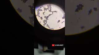 Yeast cell | Microbiology | microscope | tjbiologist  | laboratory | Medical | culture plate