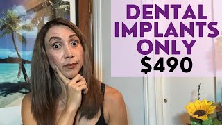 Dental Implants