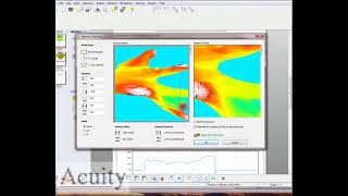 White Light Confocal Scan of a Mouse's Tendon - Part one of two