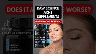 Raw Science Acne Supplements #acnetreatment #acneproneskin