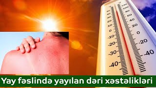 Yay fəslində yayılan dəri xəstəlikləri #dermatoloq