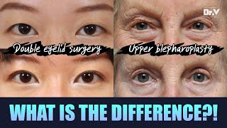 Facelift FAQ) upper blepharoplasty VS double eyelid surgery