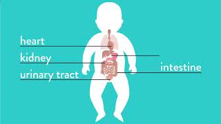 Conditions Explained: Esophageal Atresia