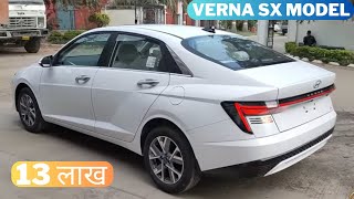 आखिर KYU लोगो KO Hyundai का SX Model सबसे ज्यादा पसंद आता है || Hyundai Verna sx model