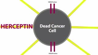 HER2 Positive Breast and Stomach Cancer Treatment Herceptin (trastuzumab)