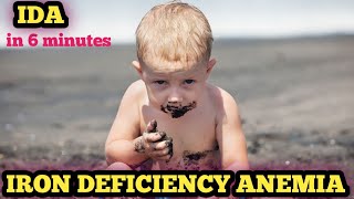 iron deficiency anemia