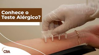 Teste Alergico ou Prick Test