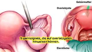 9 Warnsignale, die auf Ovarialzysten hinweisen können