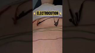 ⚡️ ELECTRO ACUPUNCTURE! RESTORE WELLNESS MELBOURNE FLORIDA 🌴  @restorewellnesscenter3521