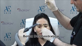 Botox Demonstration 27a Upper Face - A E Skin - Encino, CA - 818-835-1833