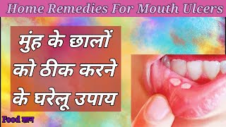 आपके मुंह में भी बार-बार निकल जाते हैं छाले तो आजमाएं ये असरदार घरेलू नुस्खे,Mouth Ulcer Remedy Tip