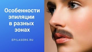 Особенности эпиляции в разных зонах | Epilasers.ru