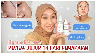 REVIEW JUJUR VAVEUR BEAUSCIENCE DAN HASIL PEMAKAIAN 14 HARI | Dissa Anesty