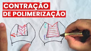 CONTRAÇÃO DE POLIMERIZAÇÃO - Mylene e Renato