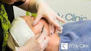 Dermaplaning Treatment | What is Dermaplaning | The Body Clinic