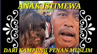 ANAK ISTIMEWA MUKANYA BERBULU #anakistimewa@Dickychannel151.