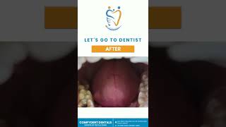 comfydent dentals  #bestdentalclinicmohali