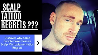 Scalp Micropigmentation Hair Tattoo Regrets