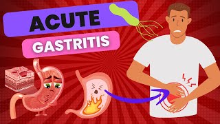 Understanding Acute Gastritis: Causes, Symptoms,Diagnosis & Treatment"