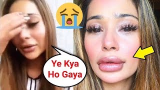 Sara Khan SH0CKING Reaction On Her Lip Job Gone Wrong