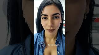 Amo la Toxina Botulínica o Botox 🥰 para tratar arrugas #avefenixestetic