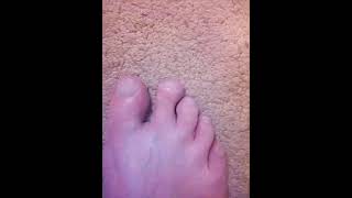 I CLIPPED MY TOES NAILS