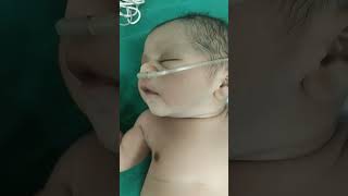 new born baby with oxgyen#plz watch my vidoes and subcribe my channel##trendingshorts