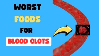 8 WORST FOODS that Cause BLOOD CLOTS to Prevent STROKES and HEART ATTACKS