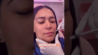 Botox Lip Flip 💉