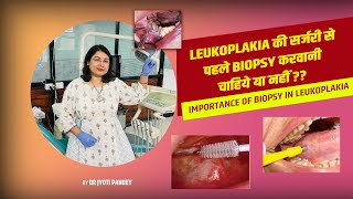 Leukoplakia की सर्जरी से पहले Biopsyकरवानी चाहिये या नहीं ??