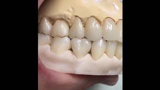 3D Pro dental zirconia multilayer features